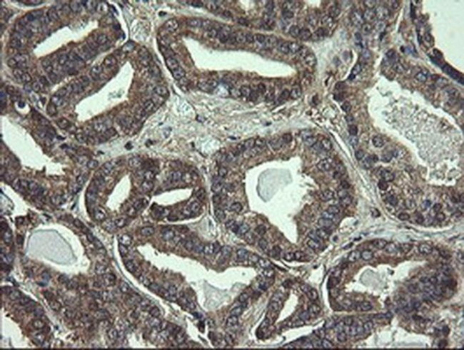 COMMD1 Antibody in Immunohistochemistry (Paraffin) (IHC (P))