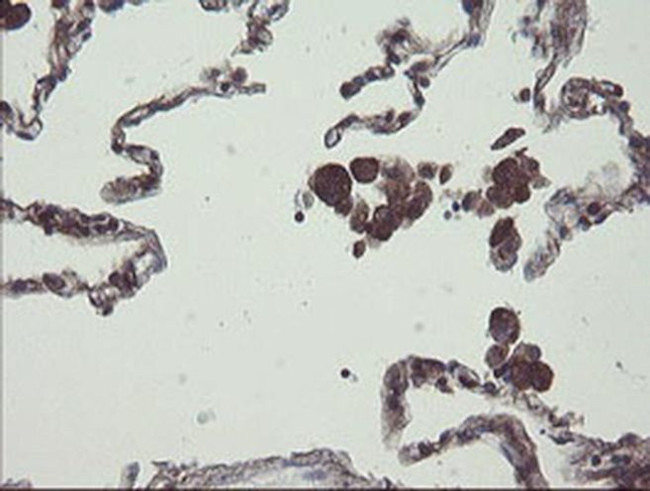 COMMD1 Antibody in Immunohistochemistry (Paraffin) (IHC (P))