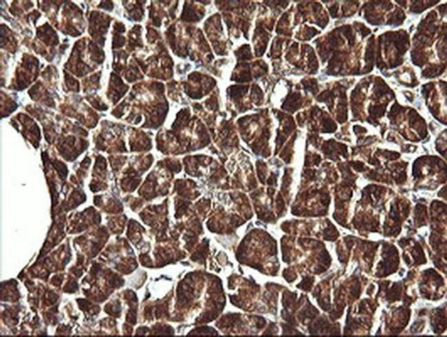 VBP1 Antibody in Immunohistochemistry (Paraffin) (IHC (P))