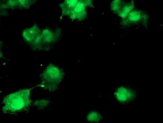 COMMD1 Antibody in Immunocytochemistry (ICC/IF)