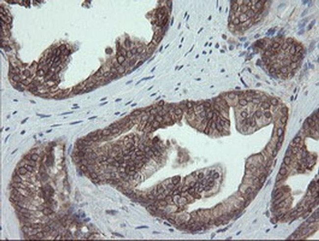 ERp57 Antibody in Immunohistochemistry (Paraffin) (IHC (P))