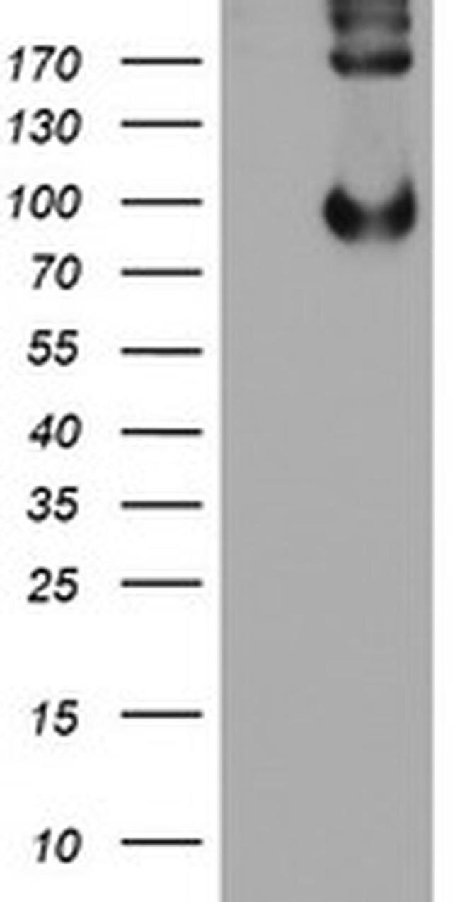 LEPRE1 Antibody in Western Blot (WB)