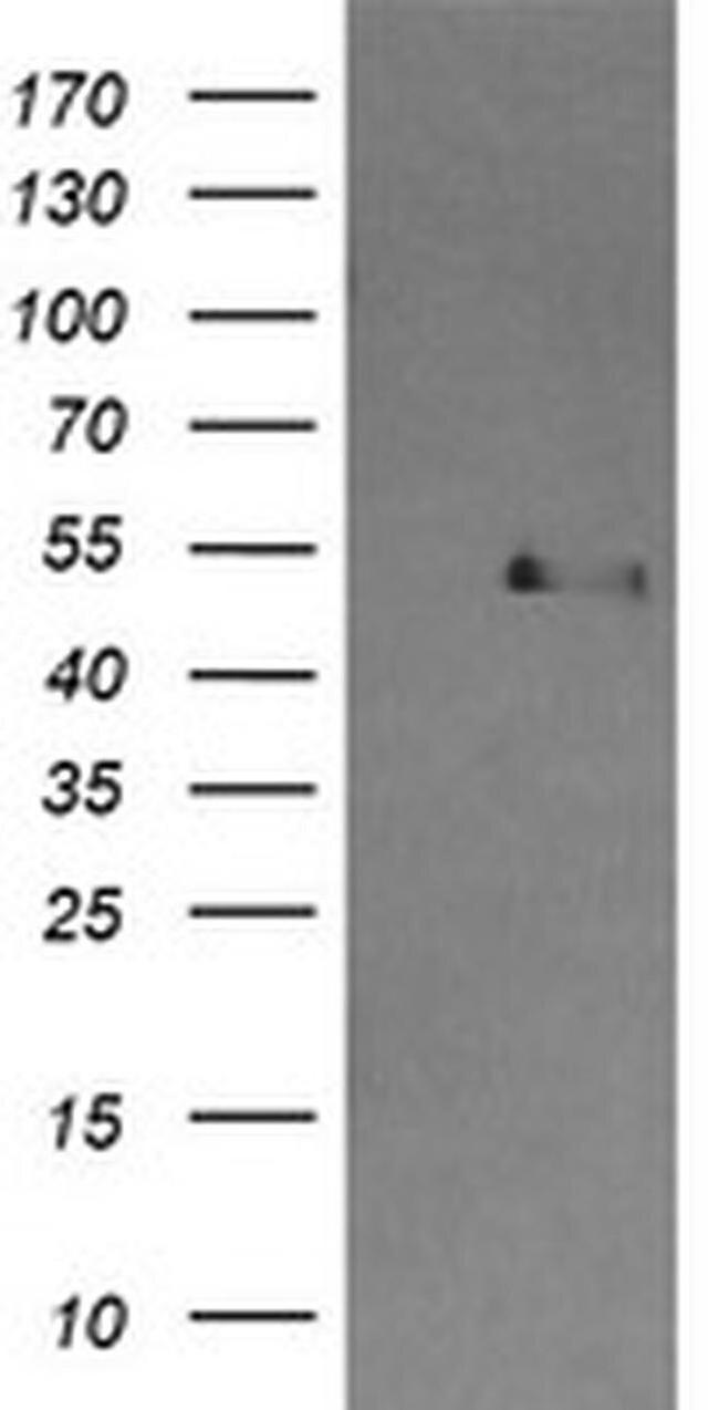 CBLC Antibody in Western Blot (WB)
