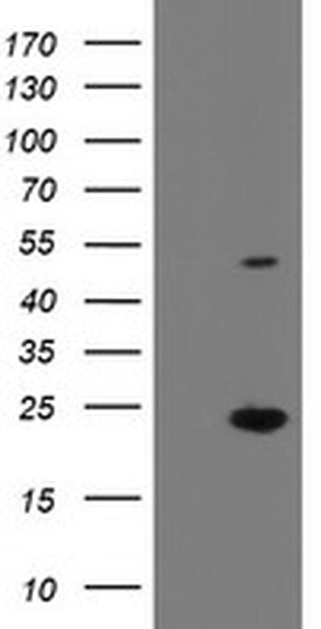 eIF5A2 Antibody in Western Blot (WB)