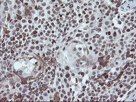 CHN1 Antibody in Immunohistochemistry (Paraffin) (IHC (P))