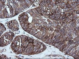 RIOK2 Antibody in Immunohistochemistry (Paraffin) (IHC (P))