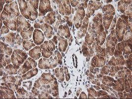 RIOK2 Antibody in Immunohistochemistry (Paraffin) (IHC (P))