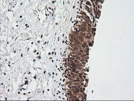 RIOK2 Antibody in Immunohistochemistry (Paraffin) (IHC (P))