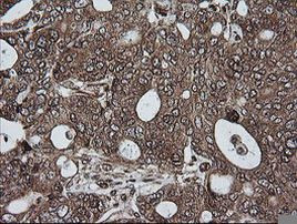 RIOK2 Antibody in Immunohistochemistry (Paraffin) (IHC (P))