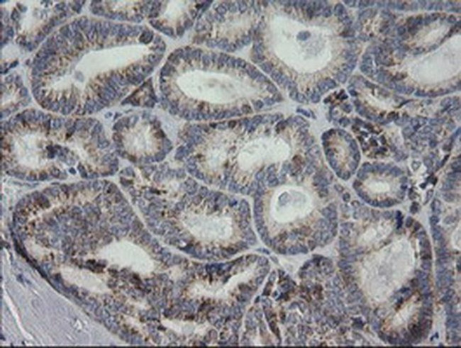 MRPS34 Antibody in Immunohistochemistry (Paraffin) (IHC (P))