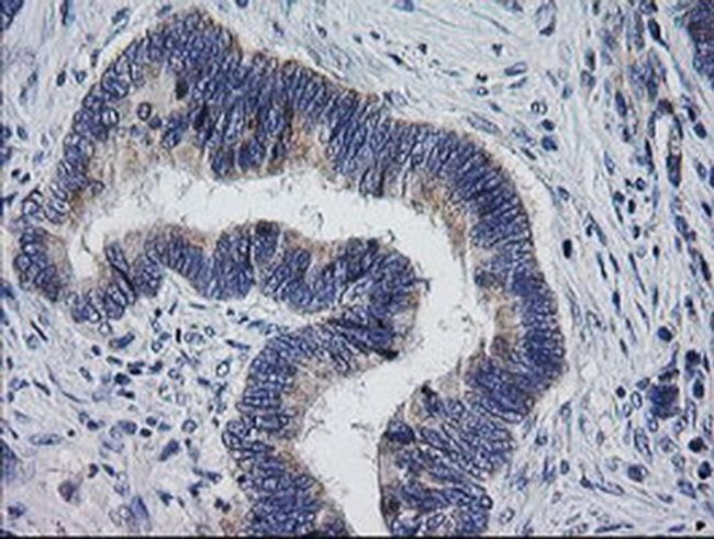 MRPS34 Antibody in Immunohistochemistry (Paraffin) (IHC (P))