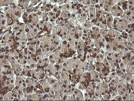 RAB30 Antibody in Immunohistochemistry (Paraffin) (IHC (P))