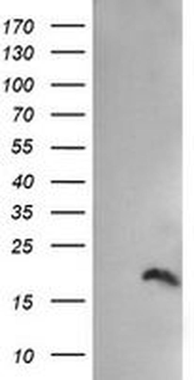 PPIL3 Antibody in Western Blot (WB)