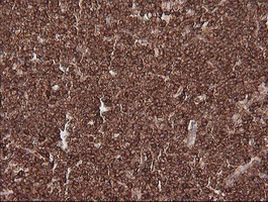 MAGEA4 Antibody in Immunohistochemistry (Paraffin) (IHC (P))