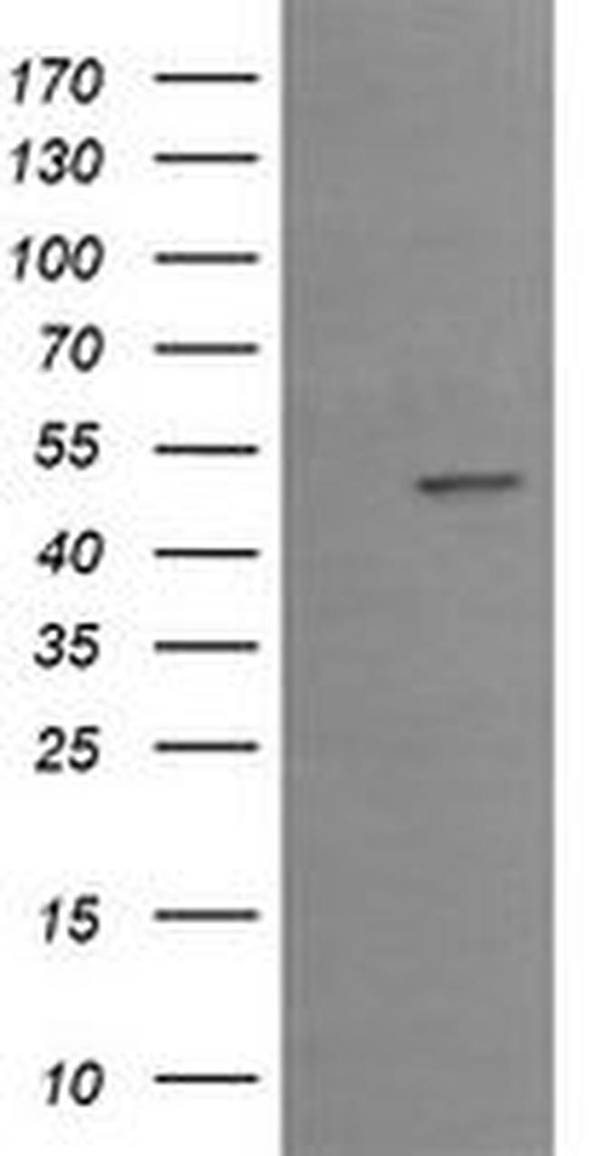 EGR2 Antibody in Western Blot (WB)