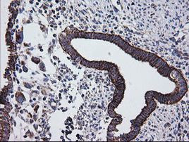 PTGES2 Antibody in Immunohistochemistry (Paraffin) (IHC (P))