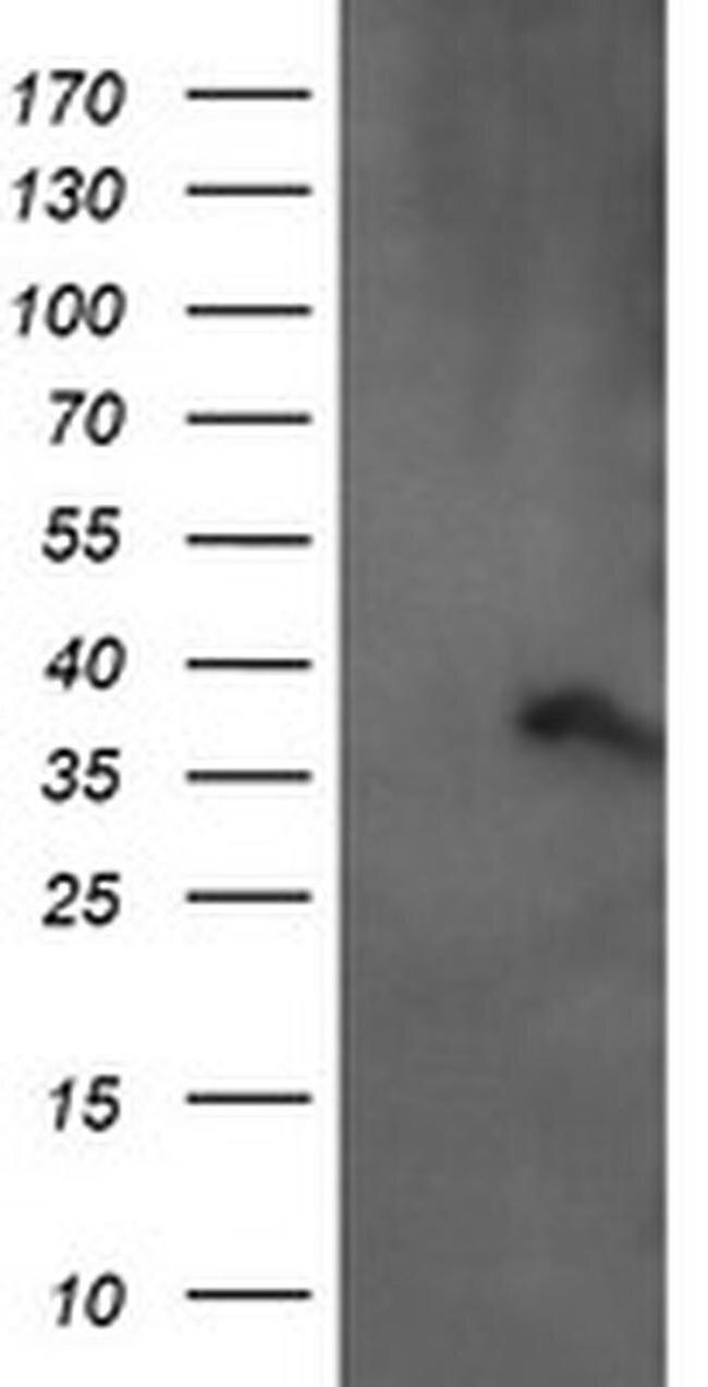 ARMC1 Antibody in Western Blot (WB)