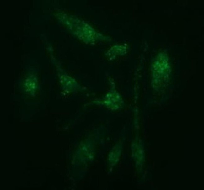 CATIP Antibody in Immunocytochemistry (ICC/IF)