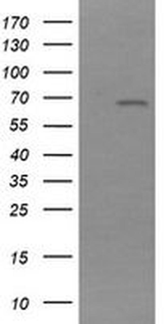 NR1 Antibody in Western Blot (WB)
