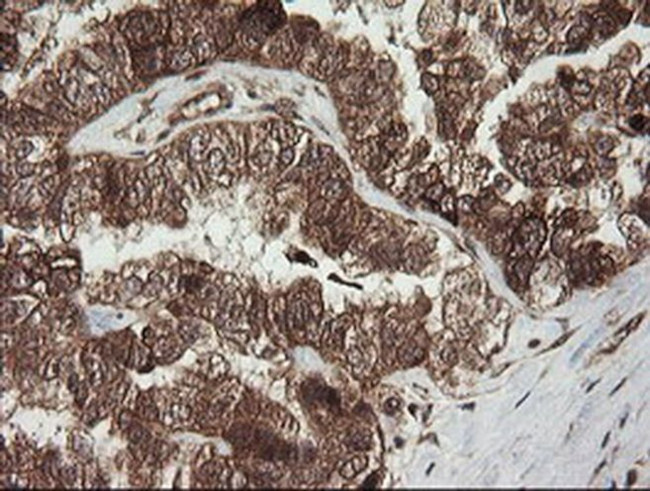 RhoJ Antibody in Immunohistochemistry (Paraffin) (IHC (P))