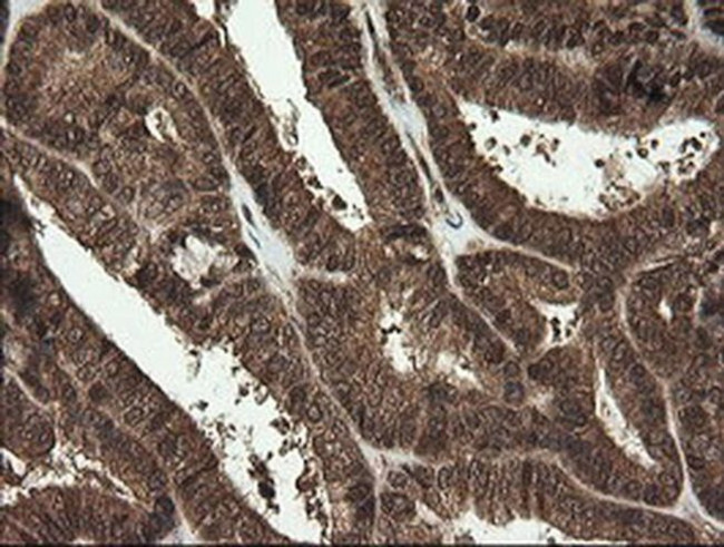 RhoJ Antibody in Immunohistochemistry (Paraffin) (IHC (P))