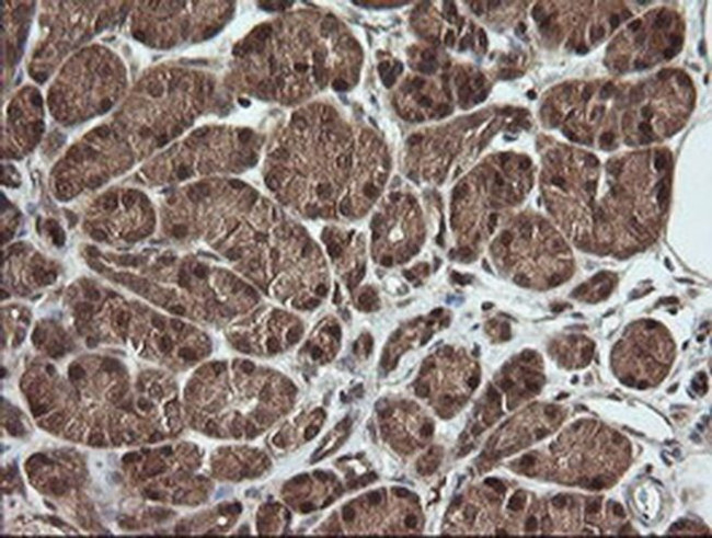 RhoJ Antibody in Immunohistochemistry (Paraffin) (IHC (P))