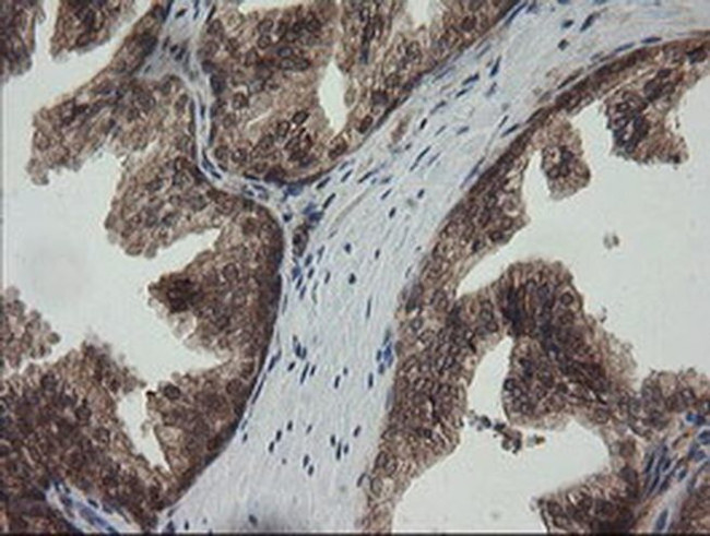 RhoJ Antibody in Immunohistochemistry (Paraffin) (IHC (P))