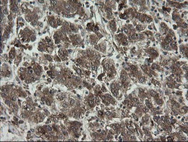 RhoJ Antibody in Immunohistochemistry (Paraffin) (IHC (P))