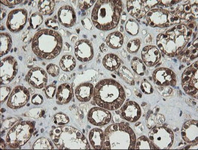 RhoJ Antibody in Immunohistochemistry (Paraffin) (IHC (P))