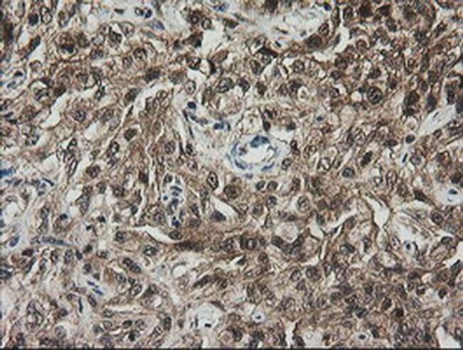 RhoJ Antibody in Immunohistochemistry (Paraffin) (IHC (P))