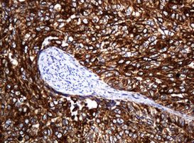 POGK Antibody in Immunohistochemistry (Paraffin) (IHC (P))