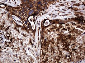 POGK Antibody in Immunohistochemistry (Paraffin) (IHC (P))