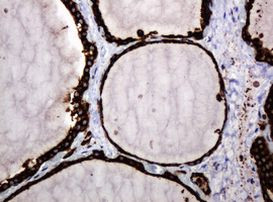 POGK Antibody in Immunohistochemistry (Paraffin) (IHC (P))