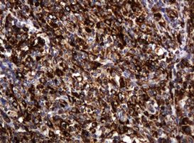 POGK Antibody in Immunohistochemistry (Paraffin) (IHC (P))