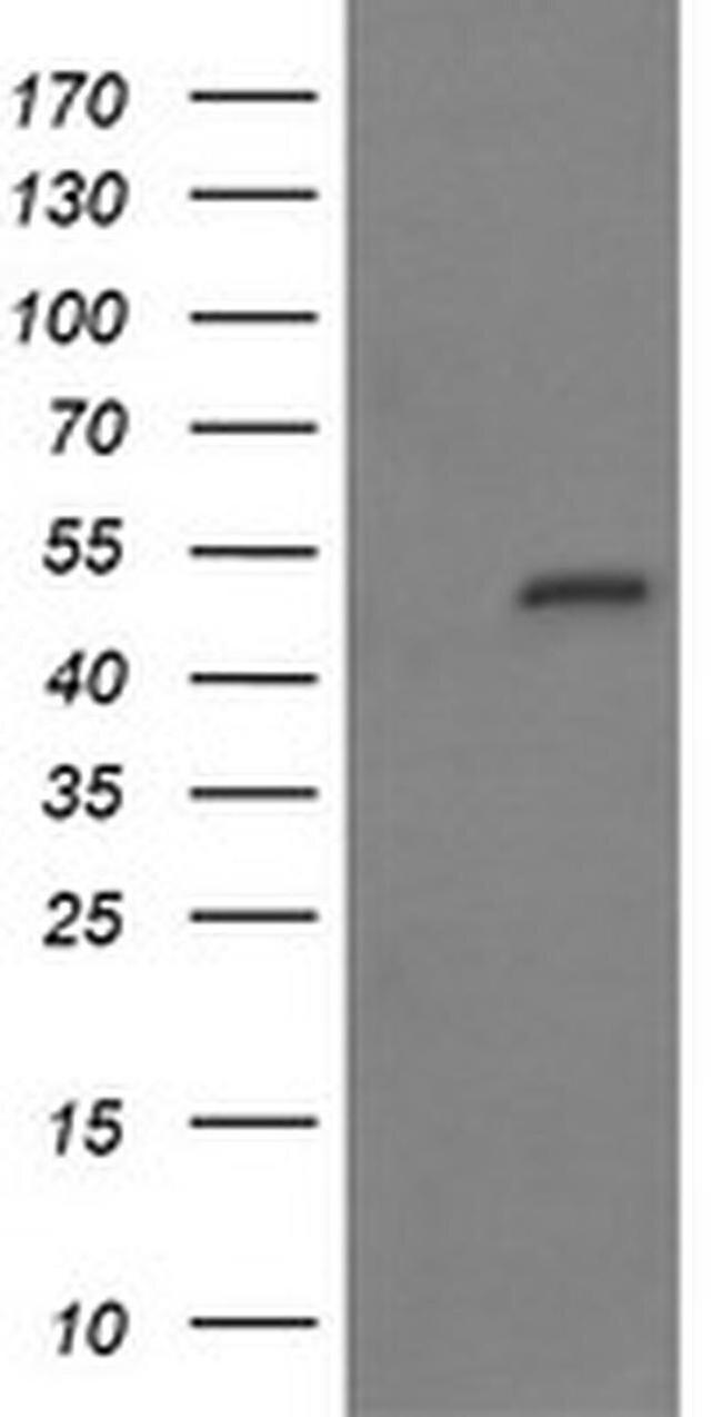 MYBPH Antibody in Western Blot (WB)