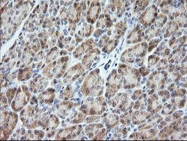 VPS28 Antibody in Immunohistochemistry (Paraffin) (IHC (P))