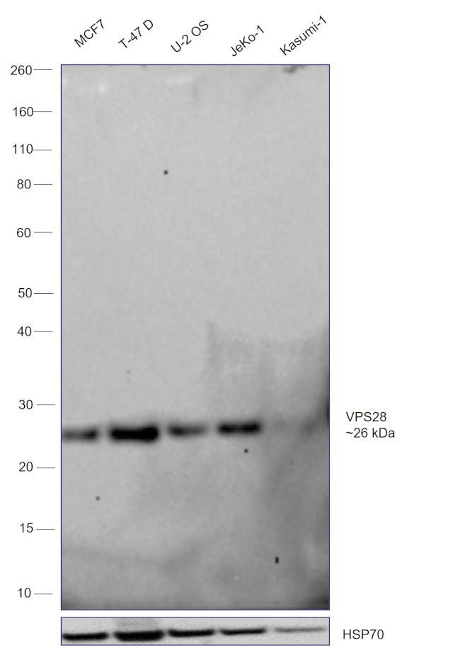 VPS28 Antibody in Western Blot (WB)