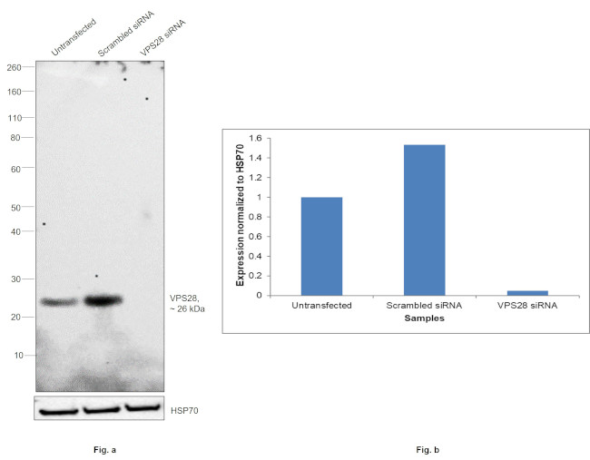 VPS28 Antibody in Western Blot (WB)