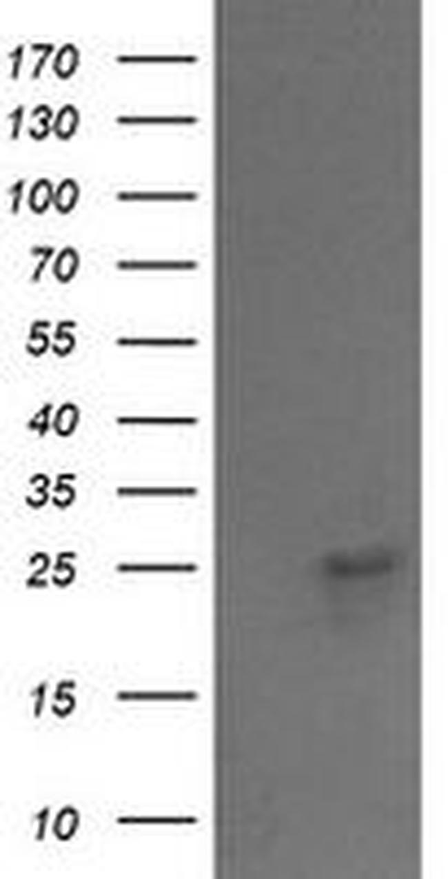 VPS28 Antibody in Western Blot (WB)