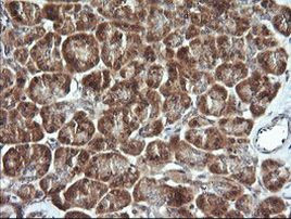 CDC123 Antibody in Immunohistochemistry (Paraffin) (IHC (P))