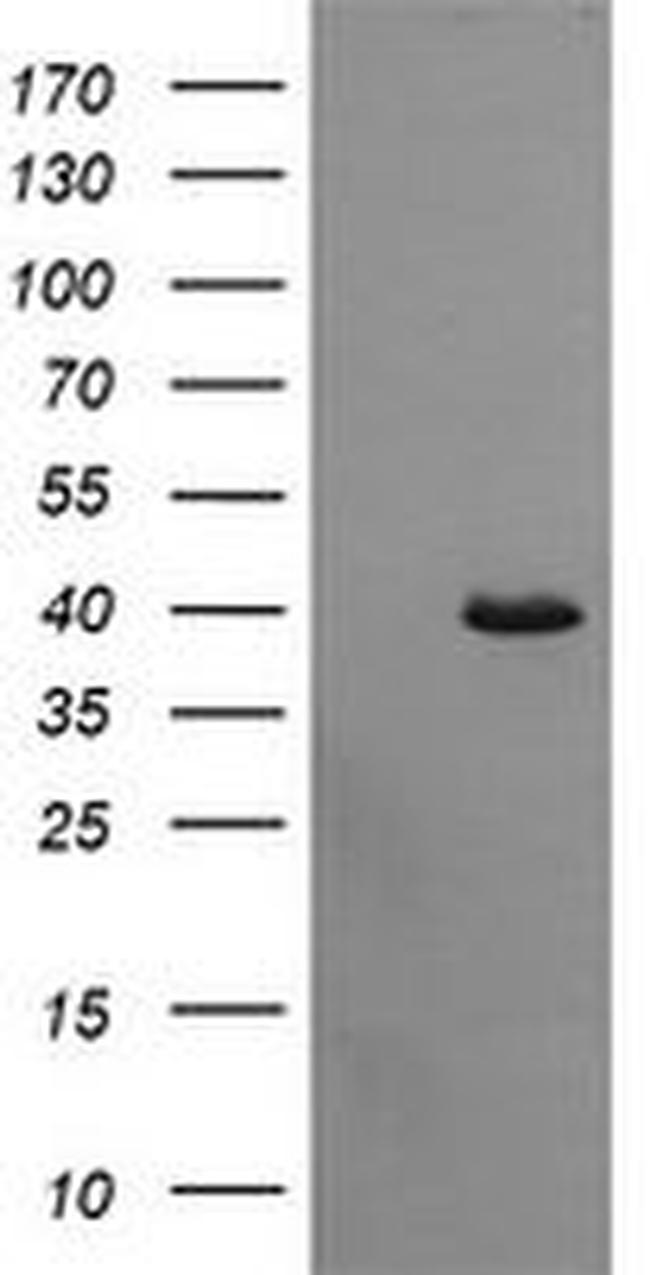 CDC123 Antibody in Western Blot (WB)