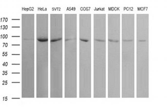 USP16 Antibody in Western Blot (WB)