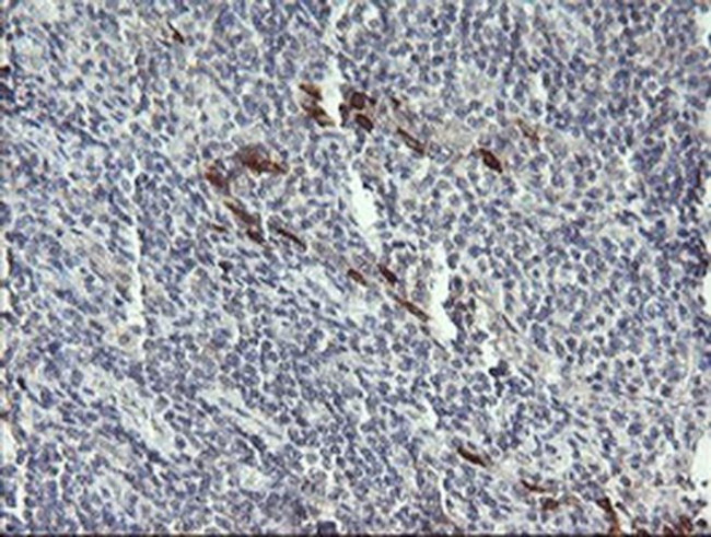 DPCD Antibody in Immunohistochemistry (Paraffin) (IHC (P))