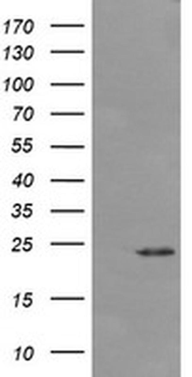 DPCD Antibody in Western Blot (WB)