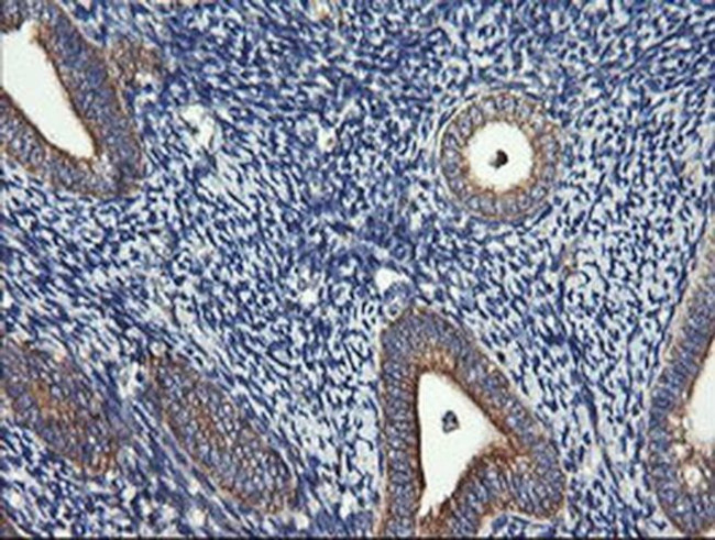 DNM1L Antibody in Immunohistochemistry (Paraffin) (IHC (P))