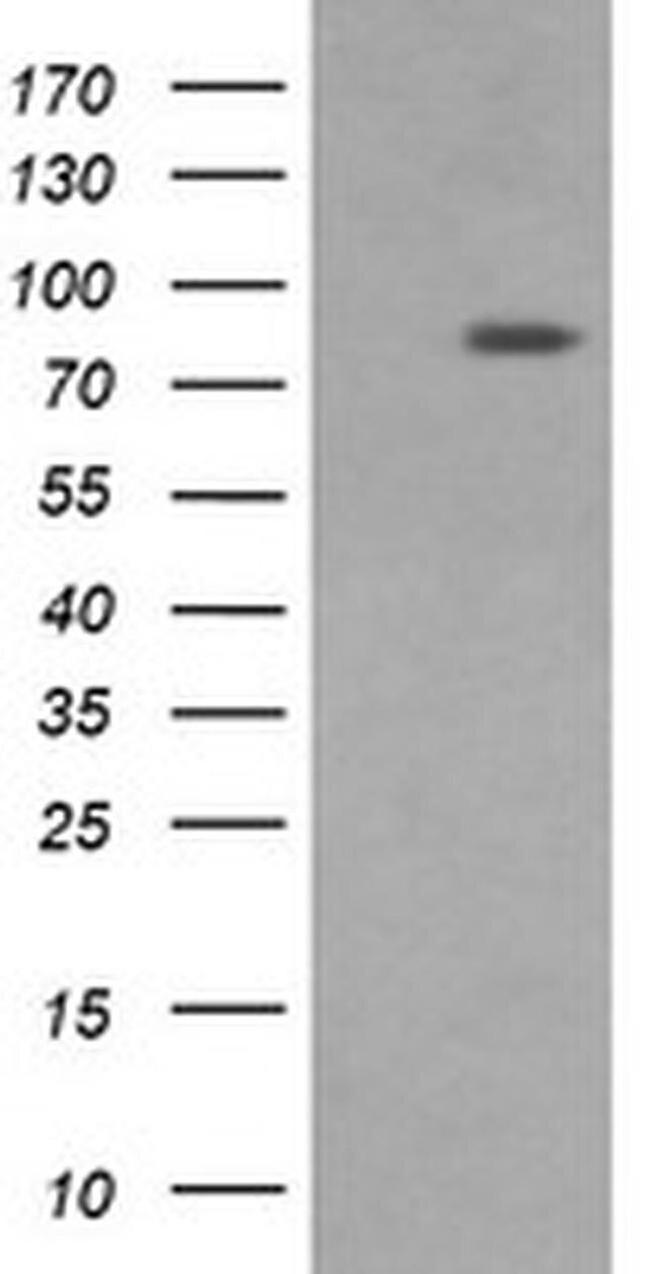 DNM1L Antibody in Western Blot (WB)