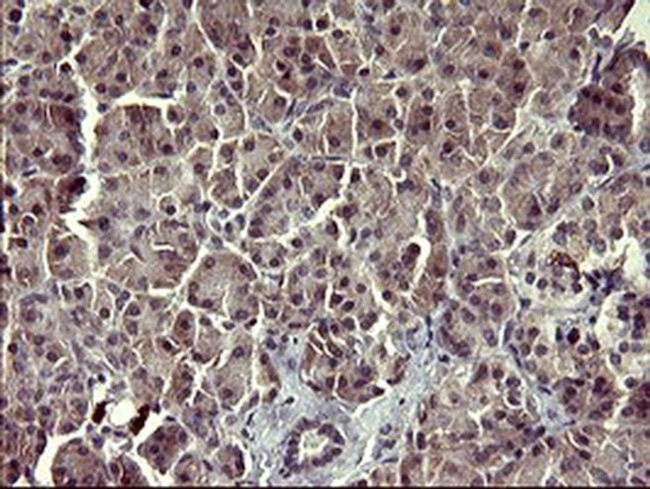 Arginase 2 Antibody in Immunohistochemistry (Paraffin) (IHC (P))