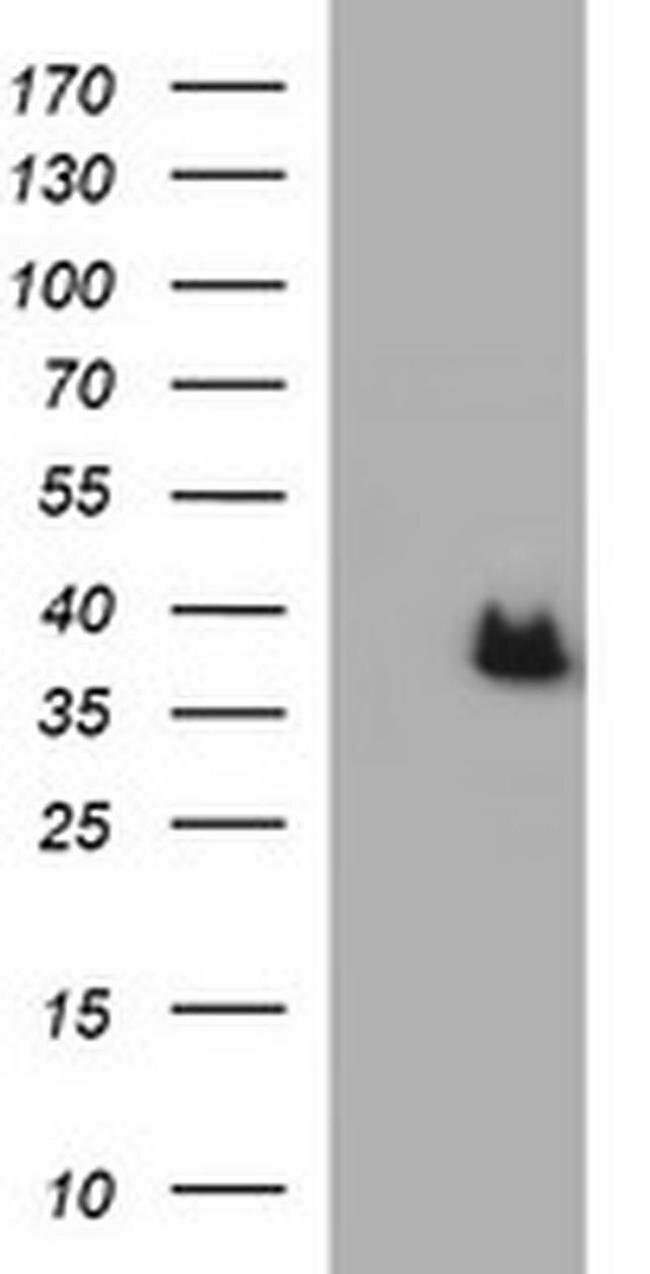 Arginase 2 Antibody in Western Blot (WB)