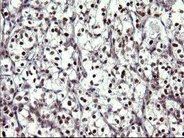 UPRT Antibody in Immunohistochemistry (Paraffin) (IHC (P))