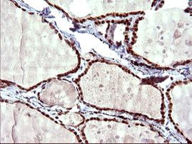 UPRT Antibody in Immunohistochemistry (Paraffin) (IHC (P))